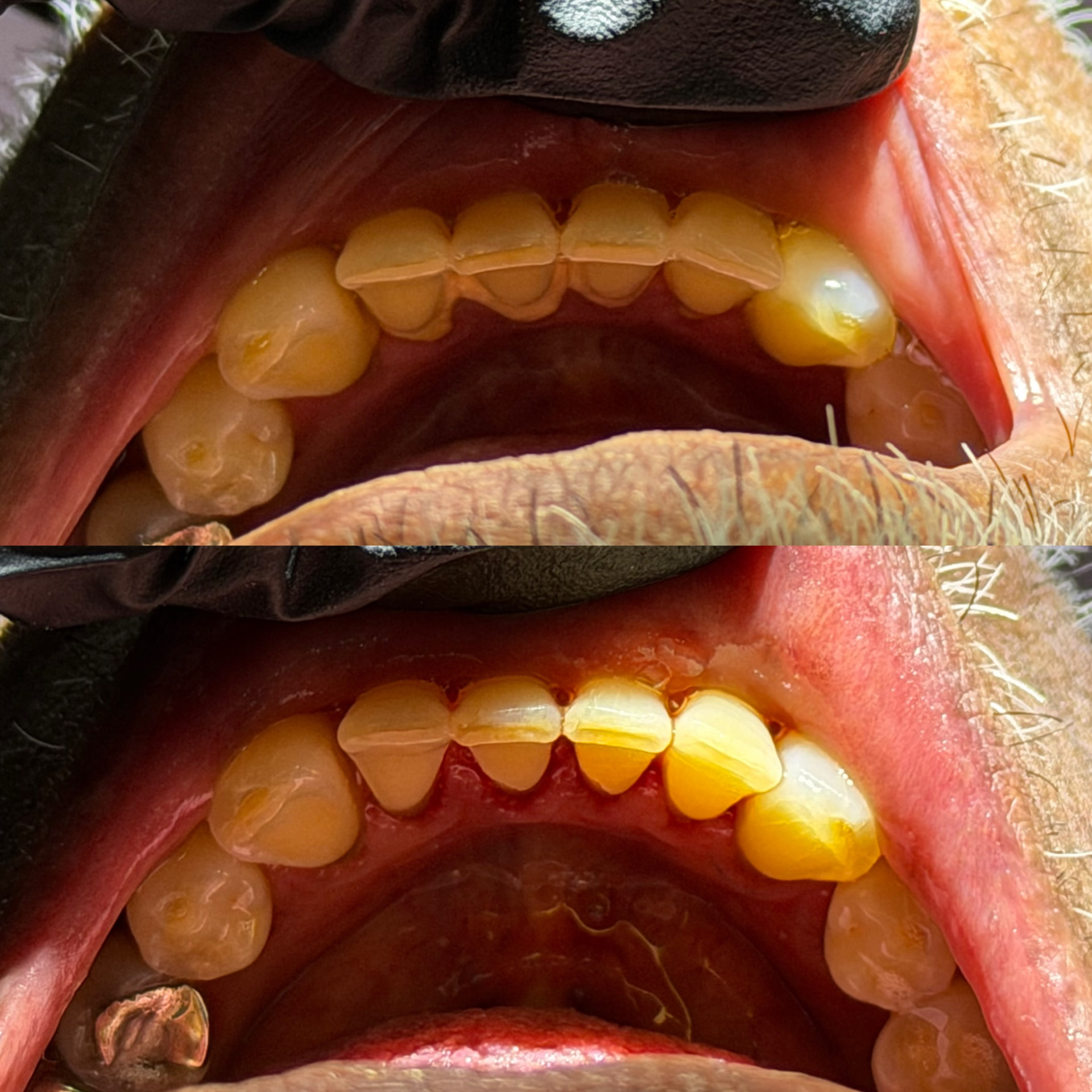 Reabilitação estética