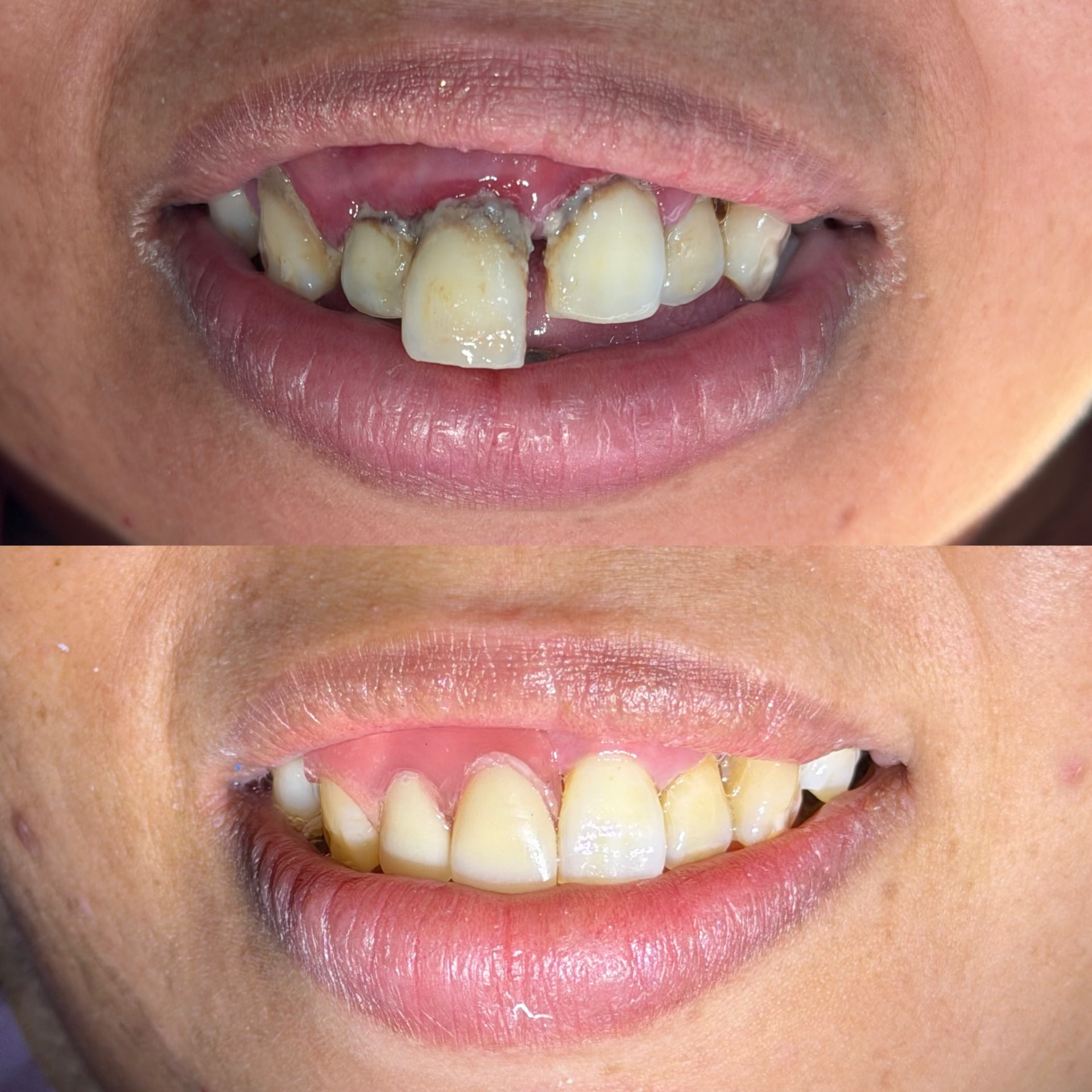Restauração estética